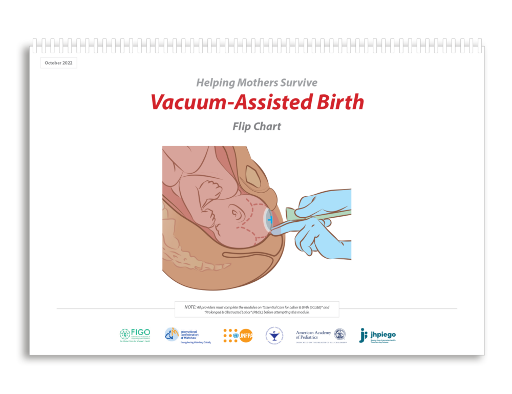 Flip-chart-VAB-e1683804436409